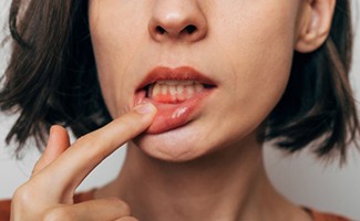 Lady has inflamed gum tissue