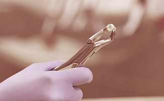 Dentist holding a tooth