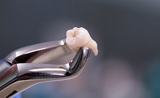 Closeup of an extracted molar